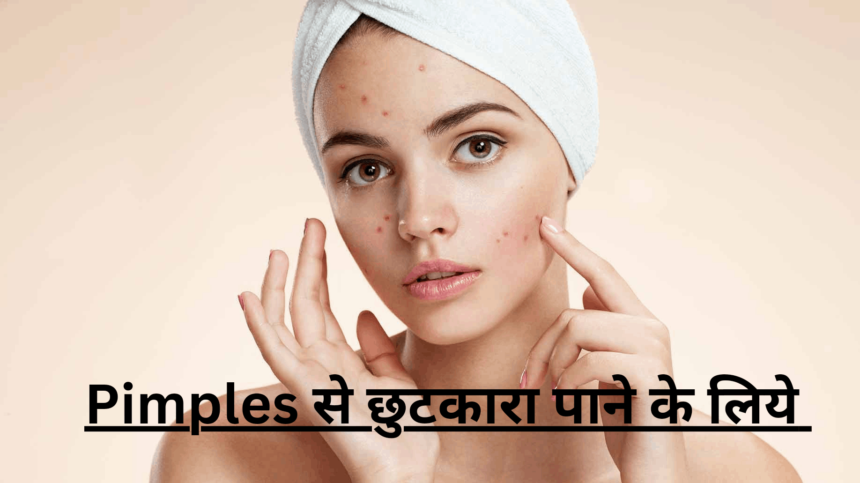 pimple से घुटकारा पाने के लिए 7 घरेलू उपाय यहां दिए गए हैं