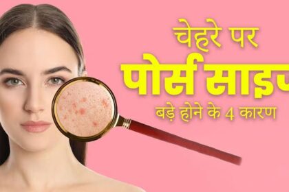 चेहरे पर ओपन पोर्स क्यों होते हैं? ओपन पोर्स से कैसे बचा जा सकता है?