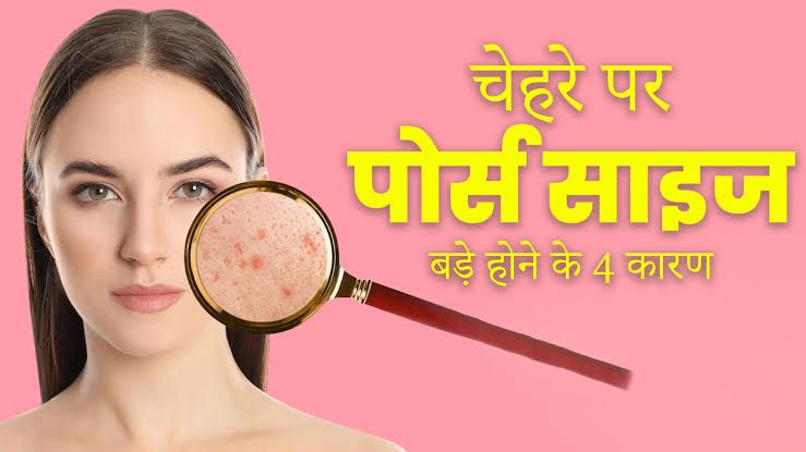 चेहरे पर ओपन पोर्स क्यों होते हैं? ओपन पोर्स से कैसे बचा जा सकता है?