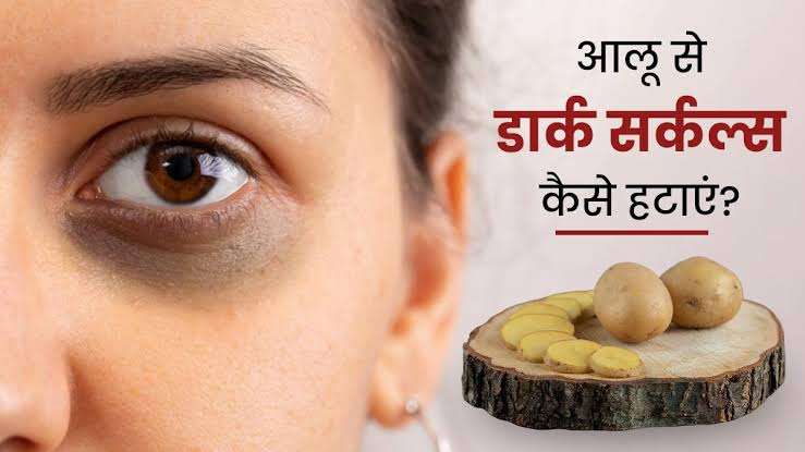 डार्क सर्कल्स से छुटकारा पाने के लिए आलू का रस
