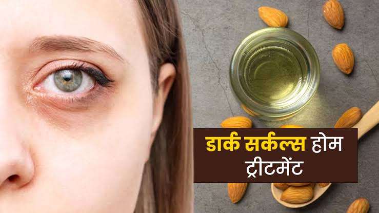 डार्क सर्कल्स से छुटकारा पाने के लिए 8 घरेलू नुस्खे || Dark circles removal tips in hindi