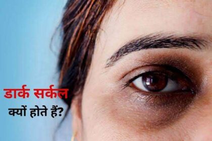 डार्क सर्कल्स कम करने के 8 रोमांचक तरीके