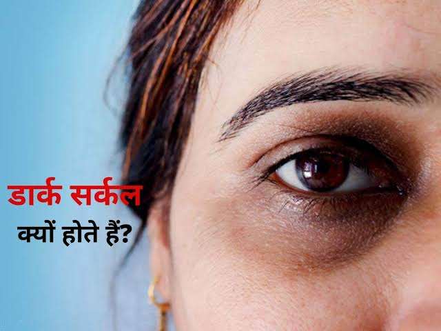 डार्क सर्कल्स कम करने के 8 रोमांचक तरीके