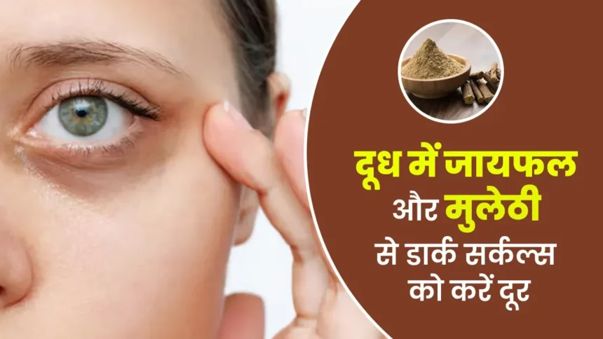 डार्क सर्कल्स कम करने के लिए क्या करें?