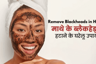 Remove Blackheads in hindi