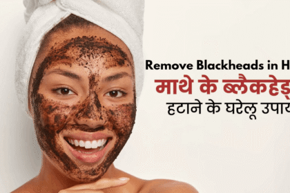 Remove Blackheads in hindi