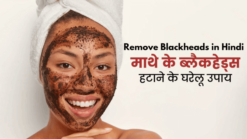 Remove Blackheads in hindi